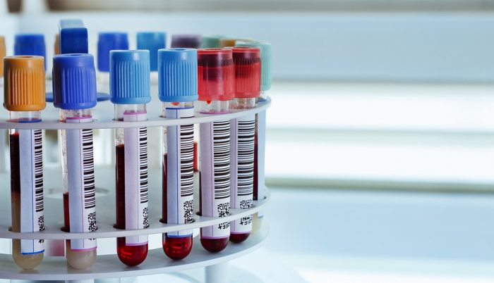 Анализ крови печеночная проба билирубин прямой и не прямой