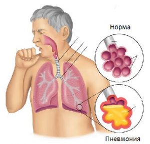 Может ли при гепатите б и цитомегаловирус