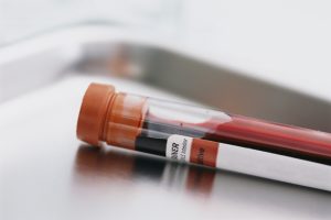 Анализ печени повышен билирубин в крови