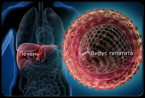 Вирусный гепатит в тяжелая форма