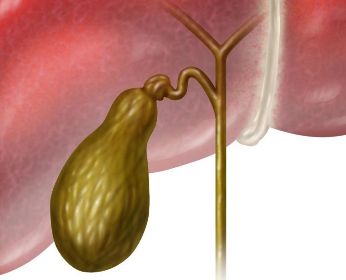 Если в желчном пузыре много желчи что делать