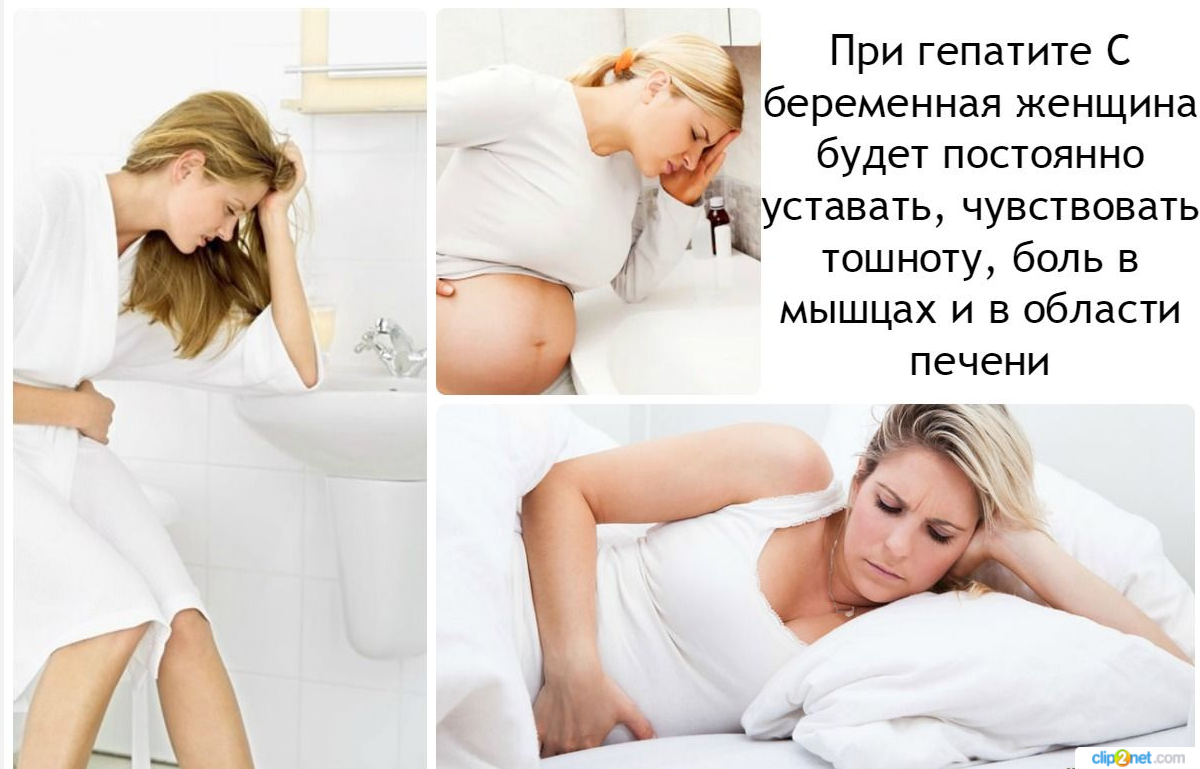 Беременность. Гепатит симптомы у беременной. Гепатит с при беременности.
