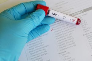 Гепатит а признаки у детей