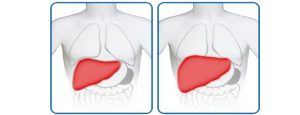 Щитовидная железа при гепатите с